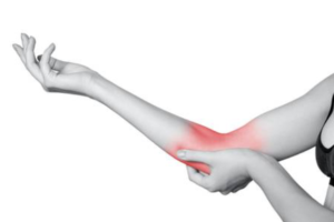 Golferselleboog Deurne fysio jansen