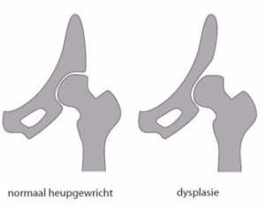 Heupdysplasie l Fysiotherapie l Fysio Jansen Deurne