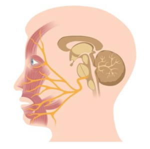Aangezichtspijn l Trigeminus Neuralgie l Oorzaak en behandeling Aangezichtspijn l Trigeminus Neuralgie l Oorzaak en behandeling
