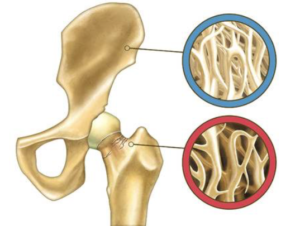 Fysio Jansen Osteoporose