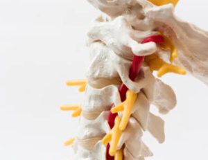 Nekhernia l Symptomen en behandeling | Fysio Jansen
